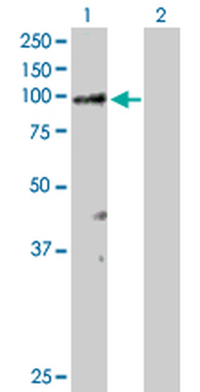 RASA3 Antibody in Western Blot (WB)