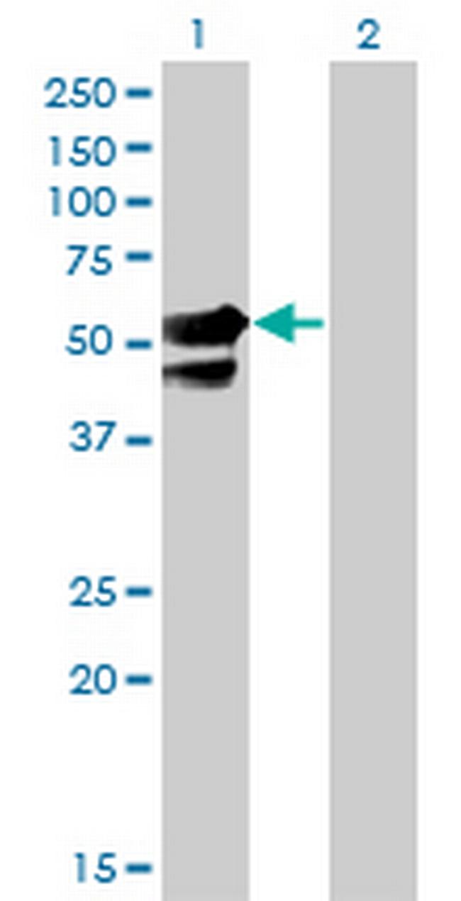 AAK1 Antibody in Western Blot (WB)