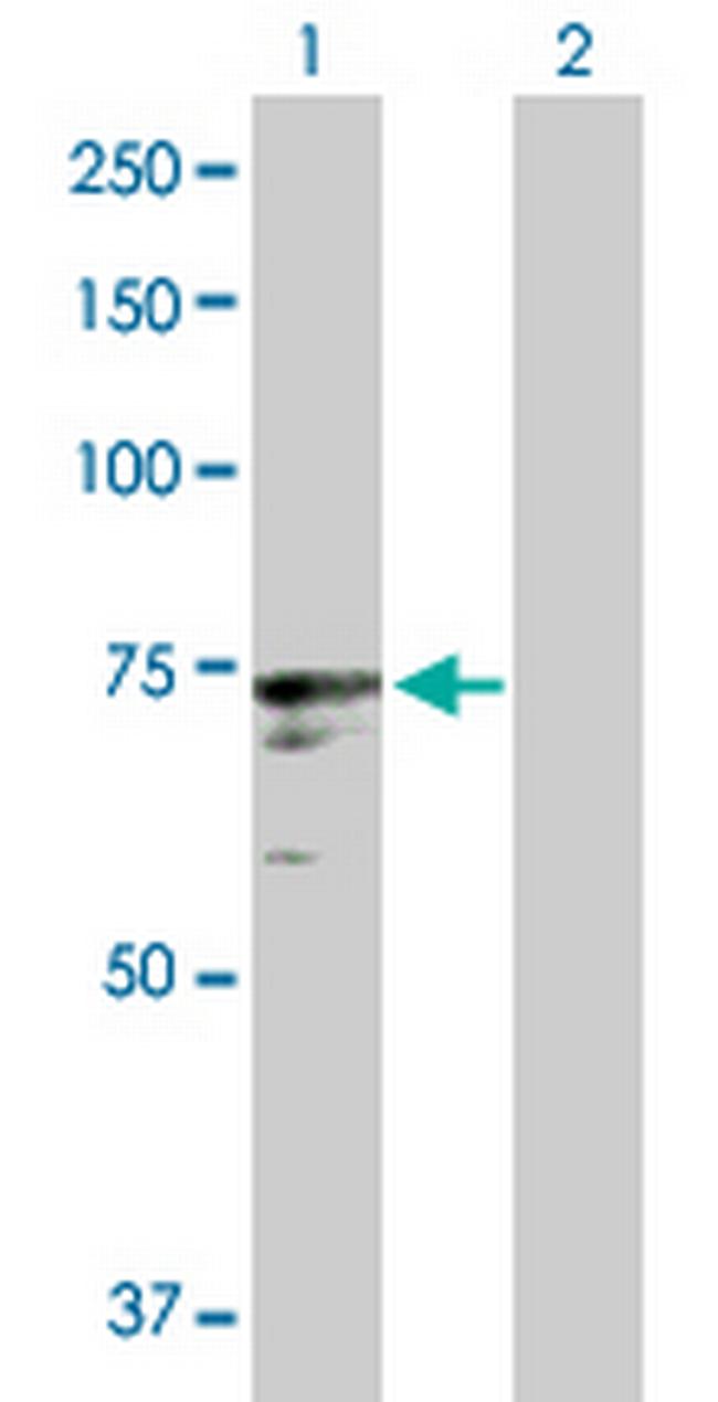 ICK Antibody in Western Blot (WB)