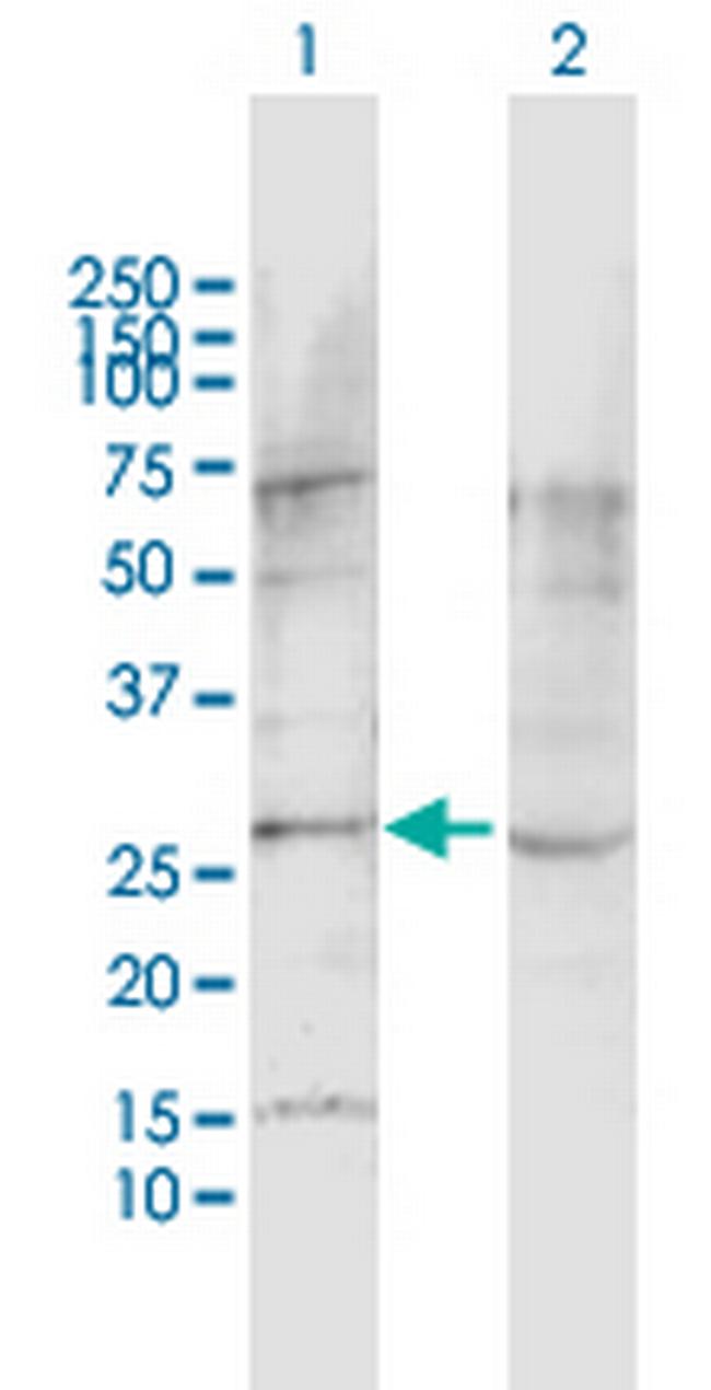 LPHN1 Antibody in Western Blot (WB)