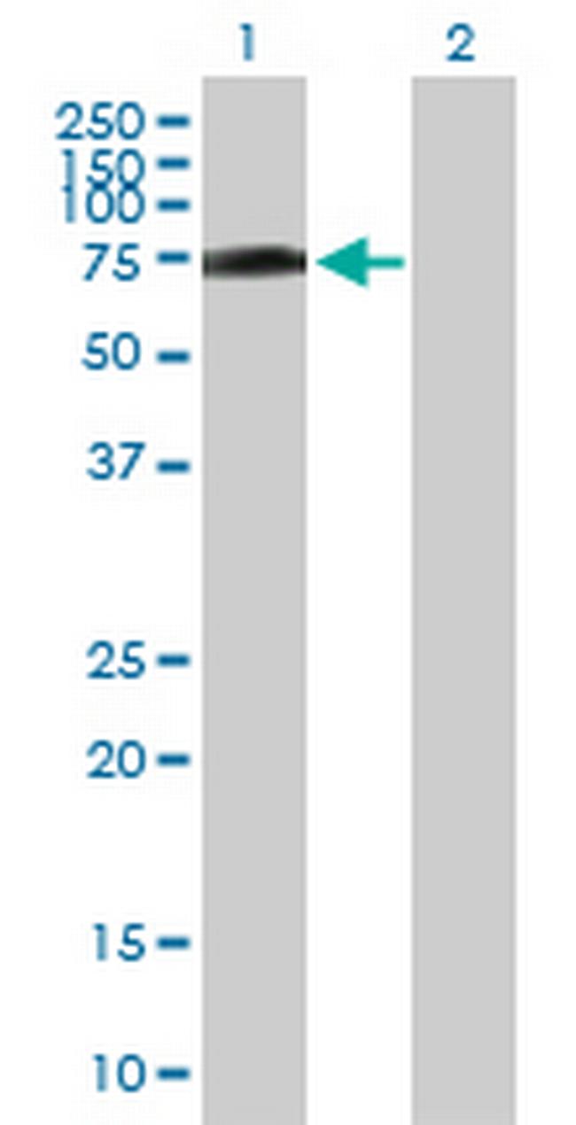 R3HDM2 Antibody in Western Blot (WB)