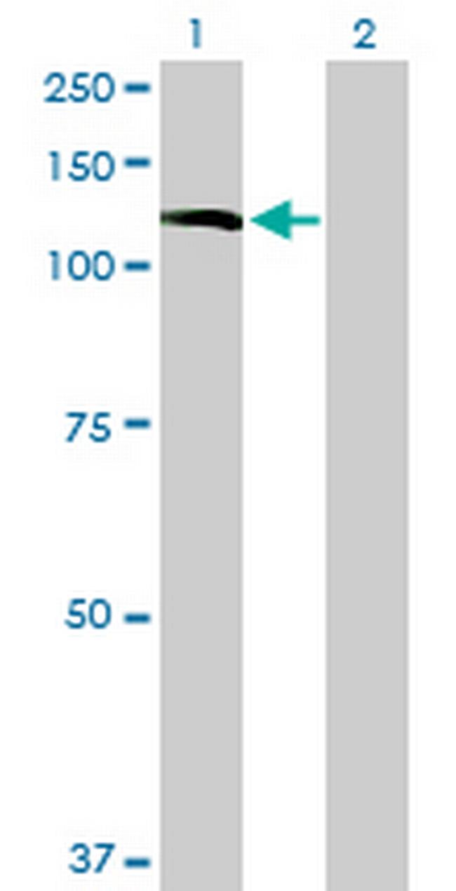 INPP5F Antibody in Western Blot (WB)