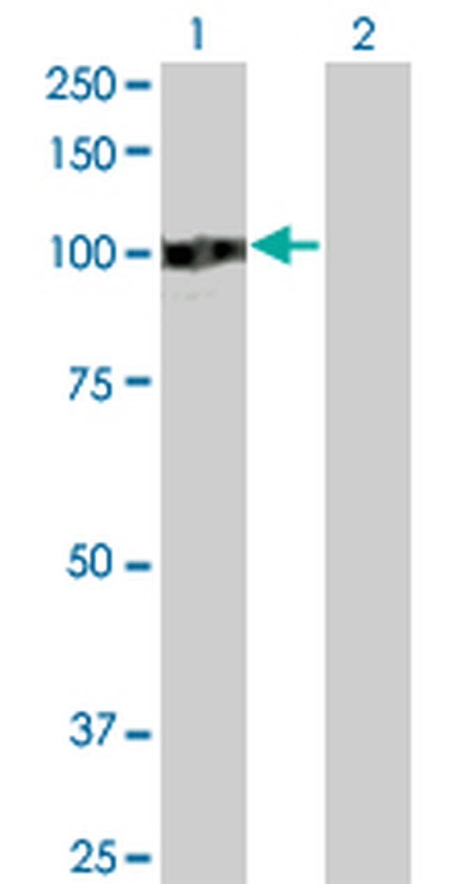 ZHX2 Antibody in Western Blot (WB)