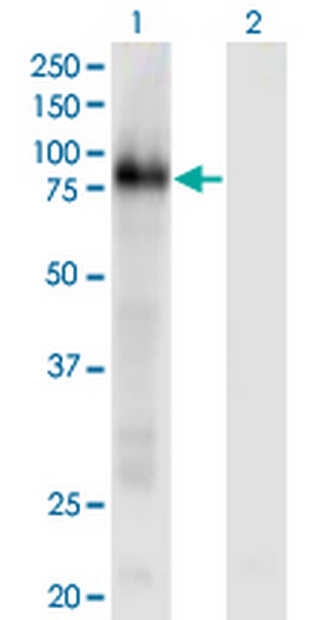CD93 Antibody in Western Blot (WB)