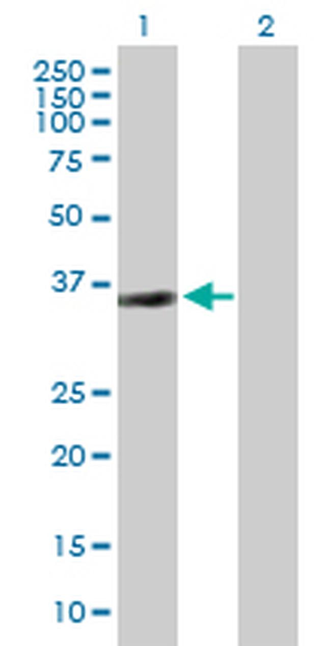 SIRT2 Antibody in Western Blot (WB)