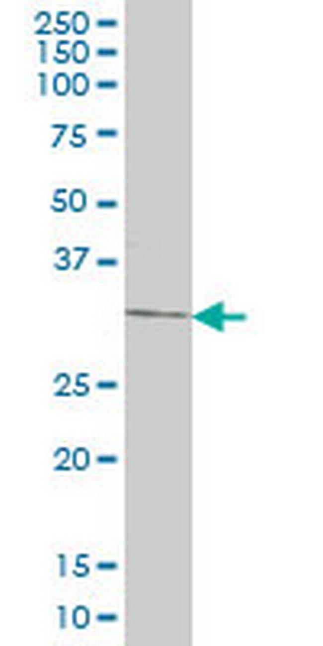 DKK1 Antibody in Western Blot (WB)