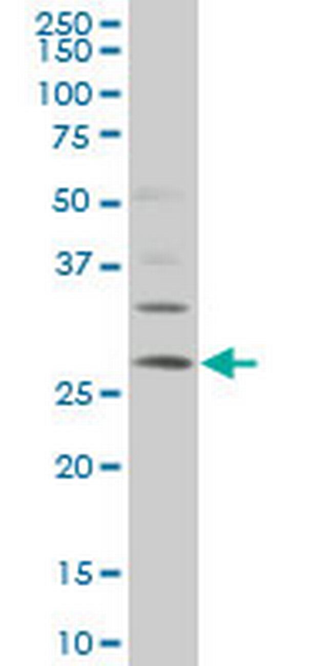 DKK1 Antibody in Western Blot (WB)