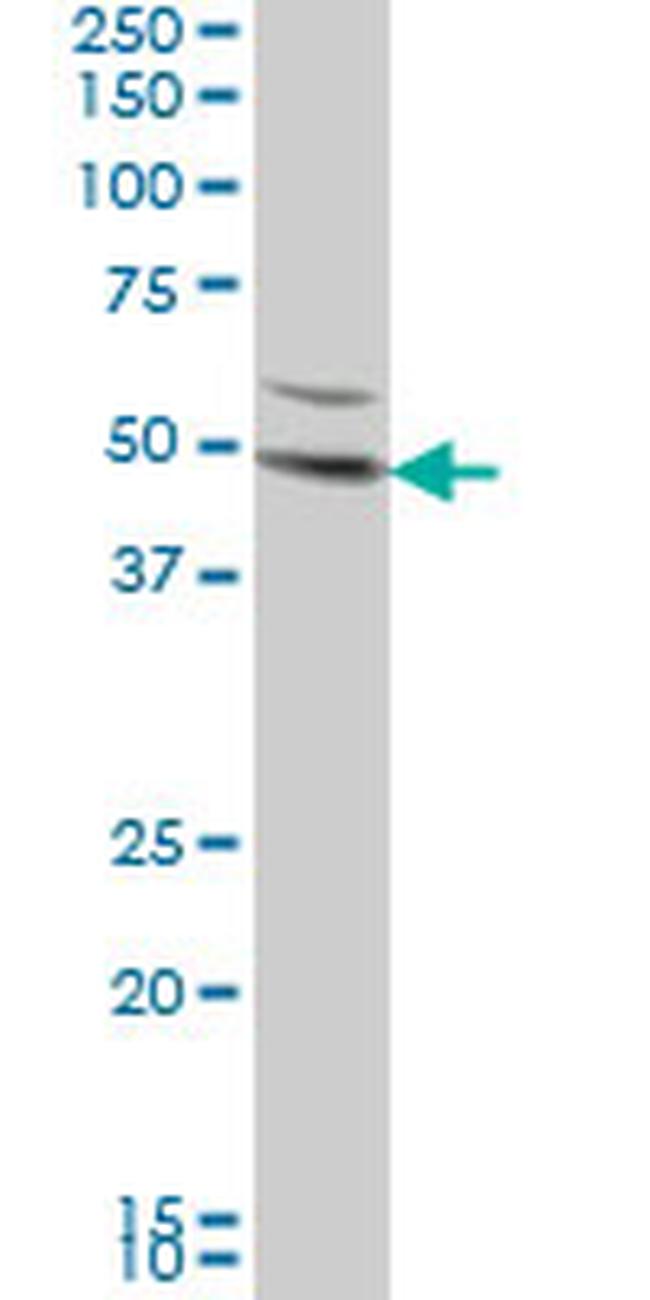 DKK1 Antibody in Western Blot (WB)