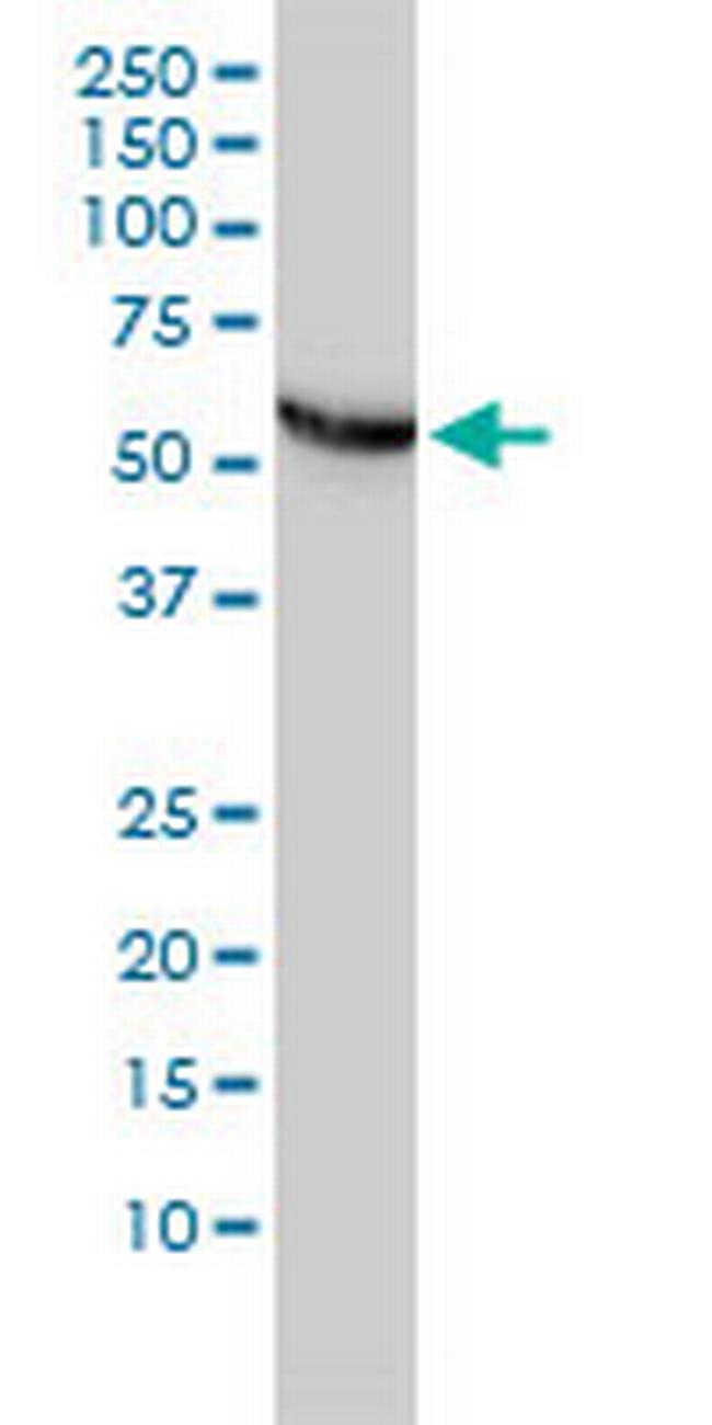 CCT5 Antibody in Western Blot (WB)