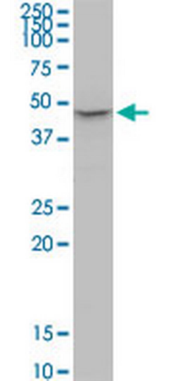 P2RX2 Antibody in Western Blot (WB)