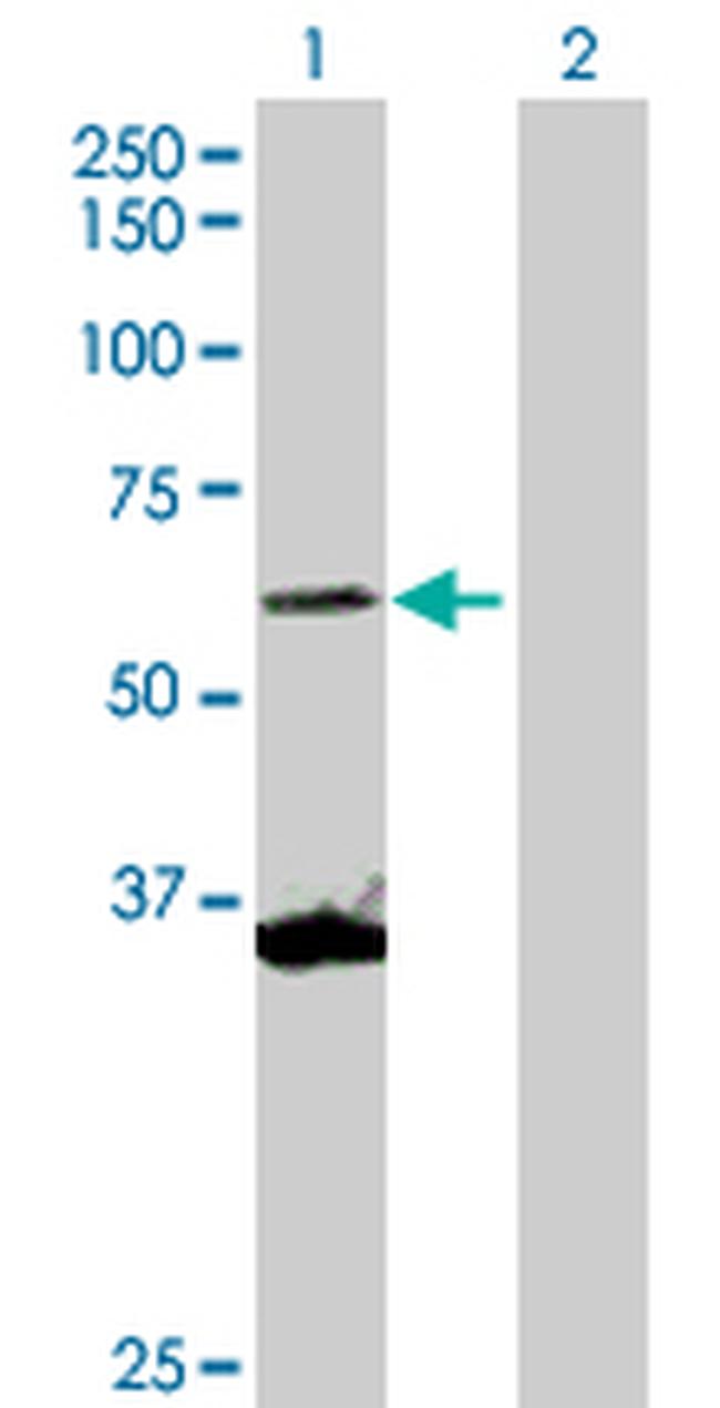 SCMH1 Antibody in Western Blot (WB)