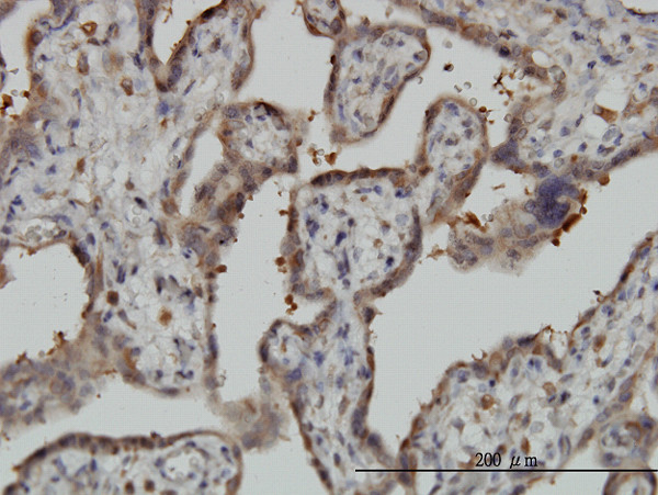 NT5C2 Antibody in Immunohistochemistry (Paraffin) (IHC (P))