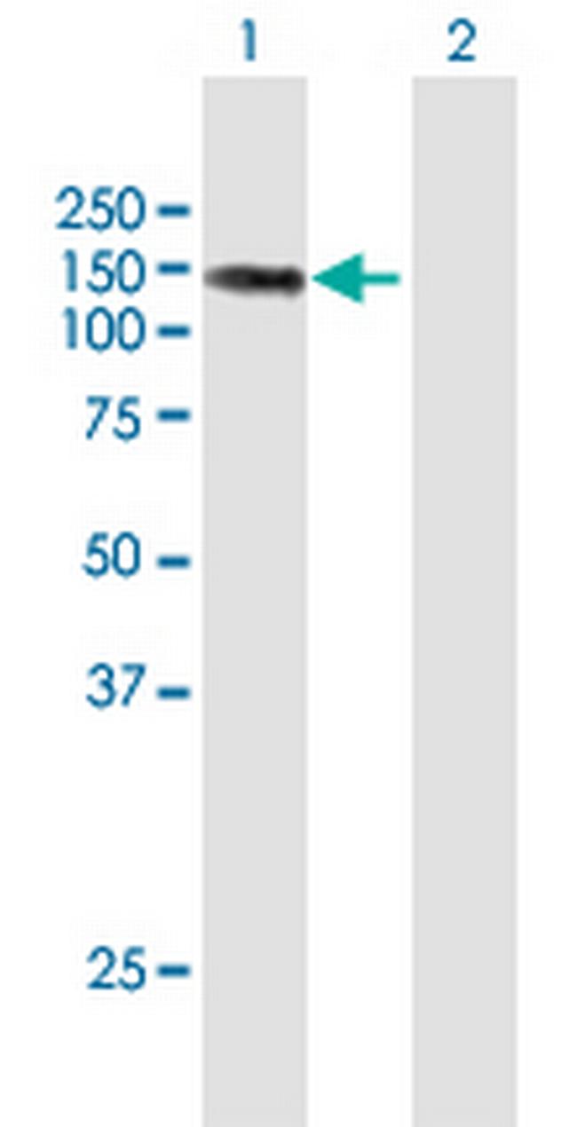 LIMCH1 Antibody in Western Blot (WB)