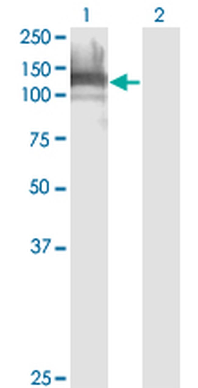 DAAM1 Antibody in Western Blot (WB)