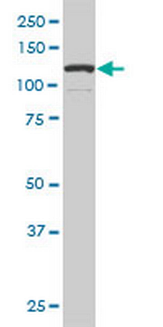 DAAM1 Antibody in Western Blot (WB)