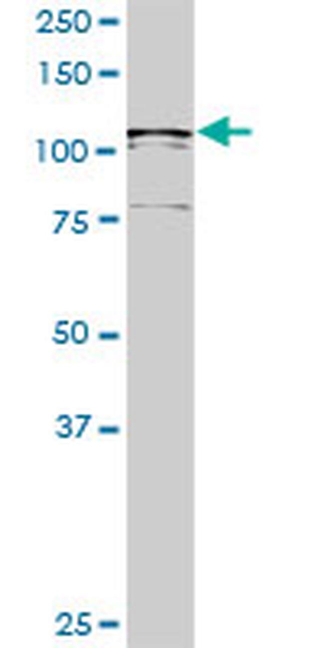 USP33 Antibody in Western Blot (WB)