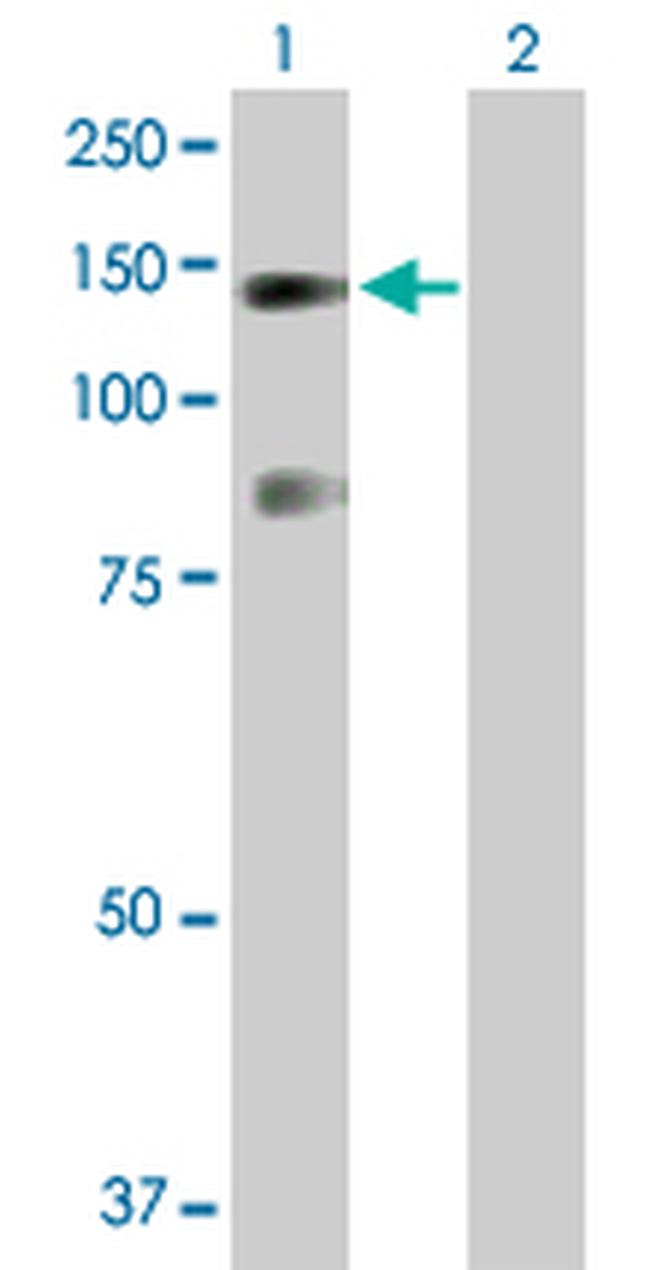 USP33 Antibody in Western Blot (WB)