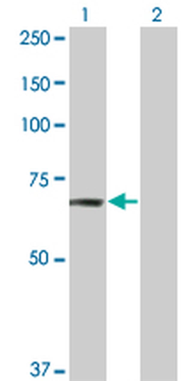 TNIK Antibody in Western Blot (WB)