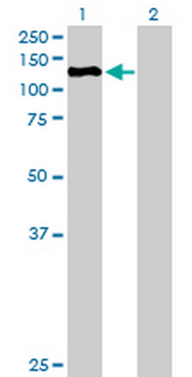 ZHX3 Antibody in Western Blot (WB)