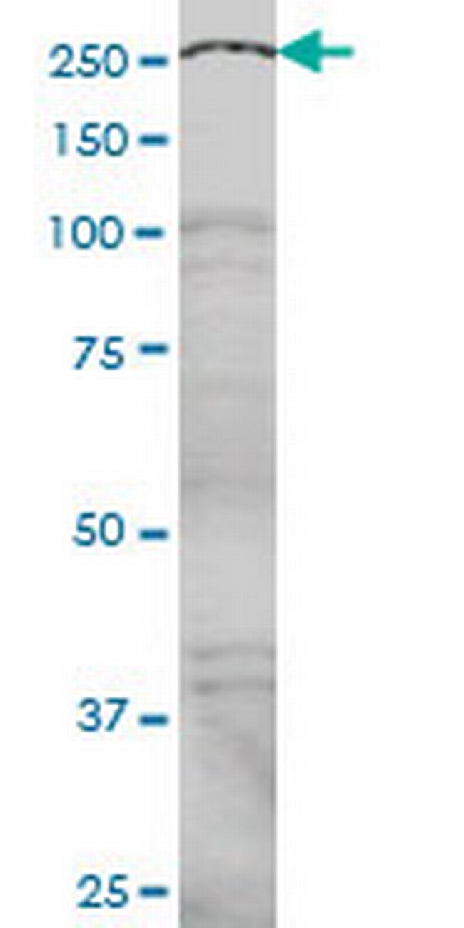 NCOA6 Antibody in Western Blot (WB)