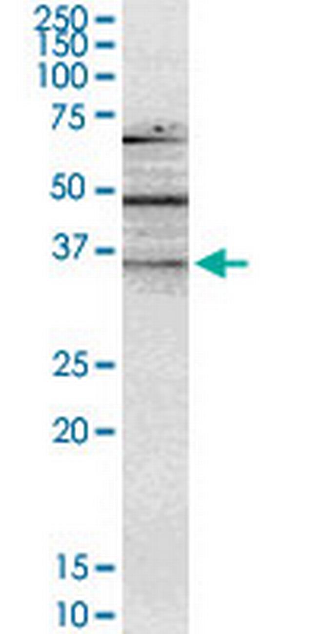 NMNAT2 Antibody in Western Blot (WB)