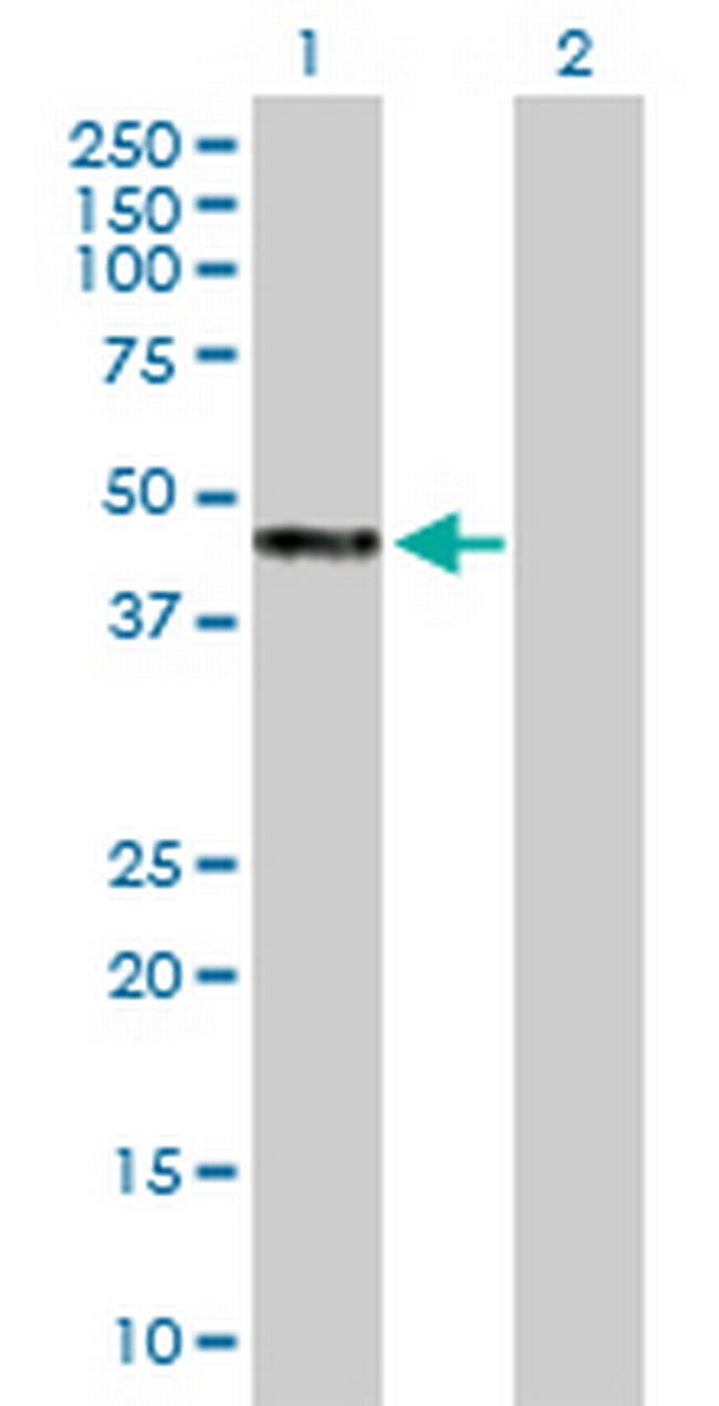 WAPAL Antibody in Western Blot (WB)