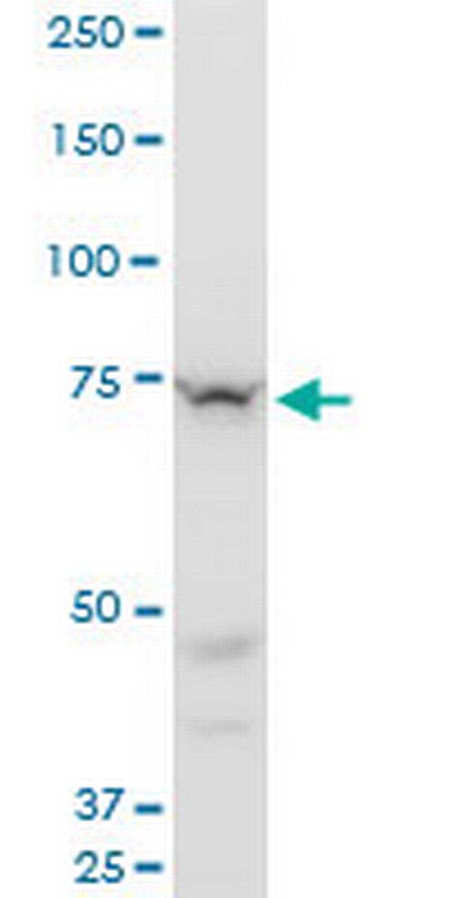 SETX Antibody in Western Blot (WB)