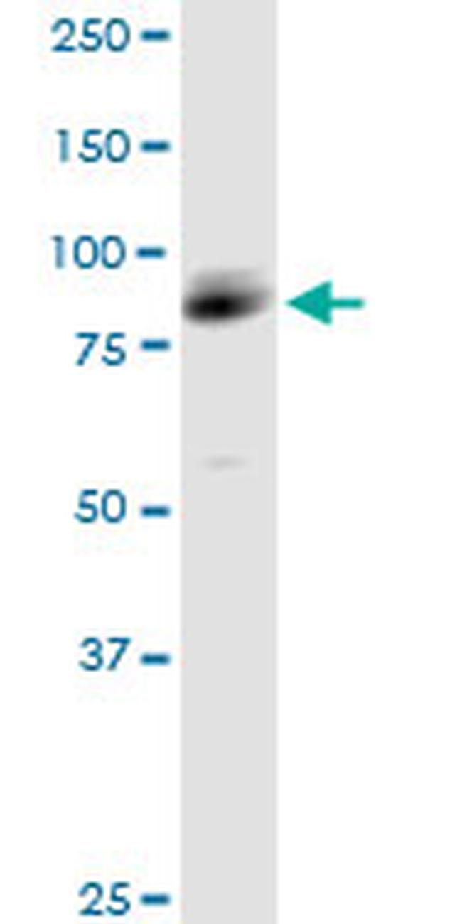 ARHGAP26 Antibody in Western Blot (WB)