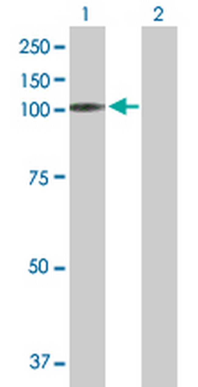 MAST2 Antibody in Western Blot (WB)