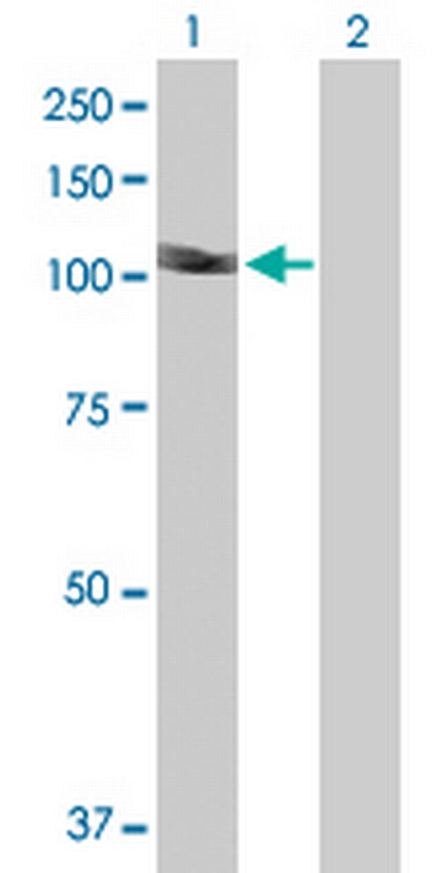 DIP2A Antibody in Western Blot (WB)