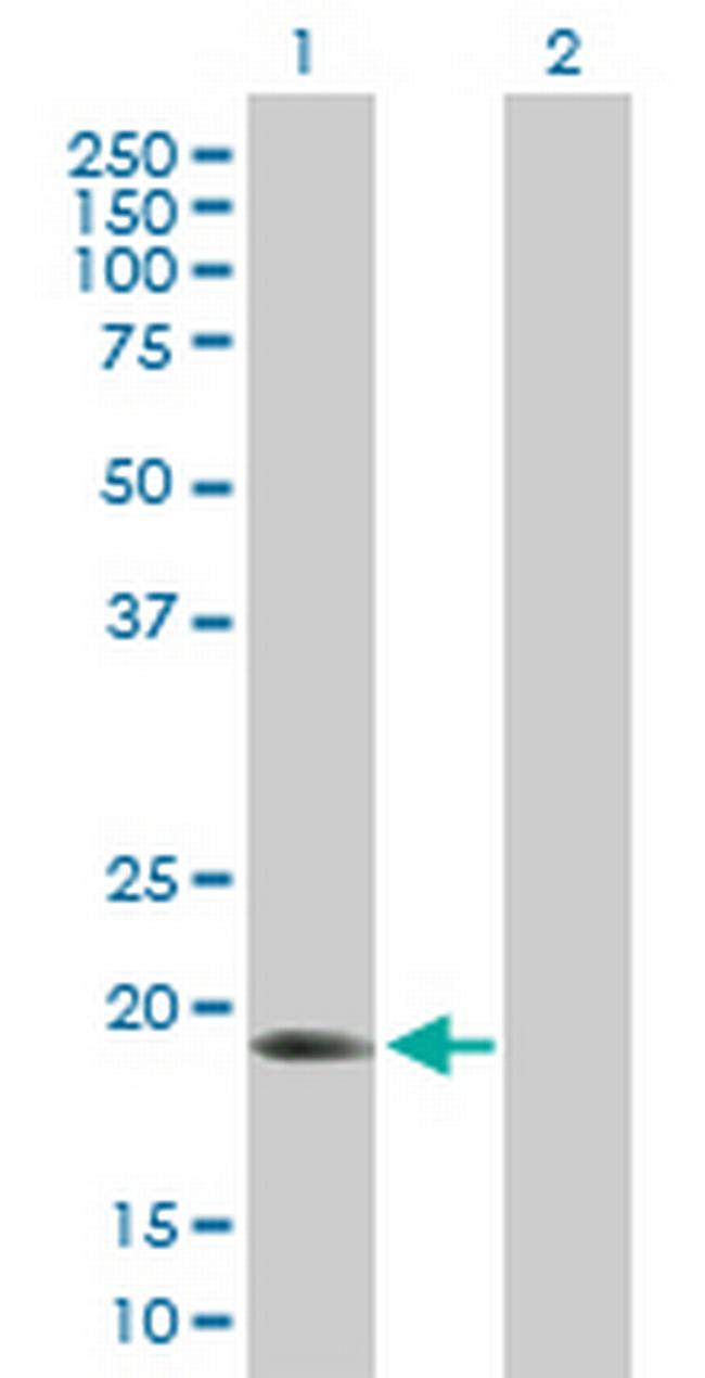 ARL6IP1 Antibody in Western Blot (WB)