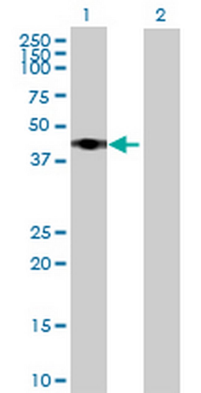 RRS1 Antibody in Western Blot (WB)