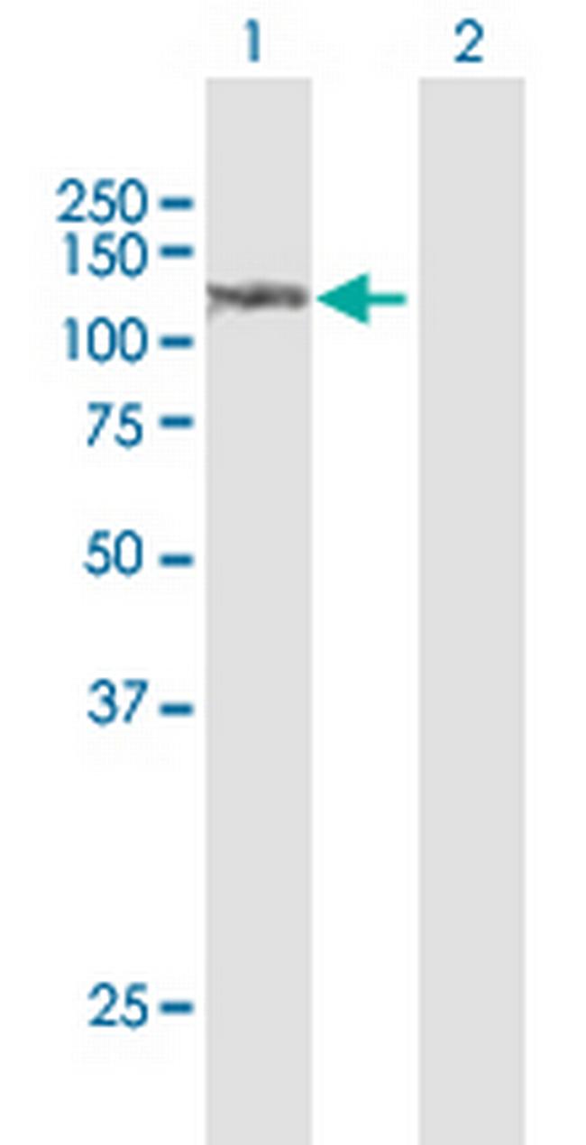 SULF1 Antibody in Western Blot (WB)