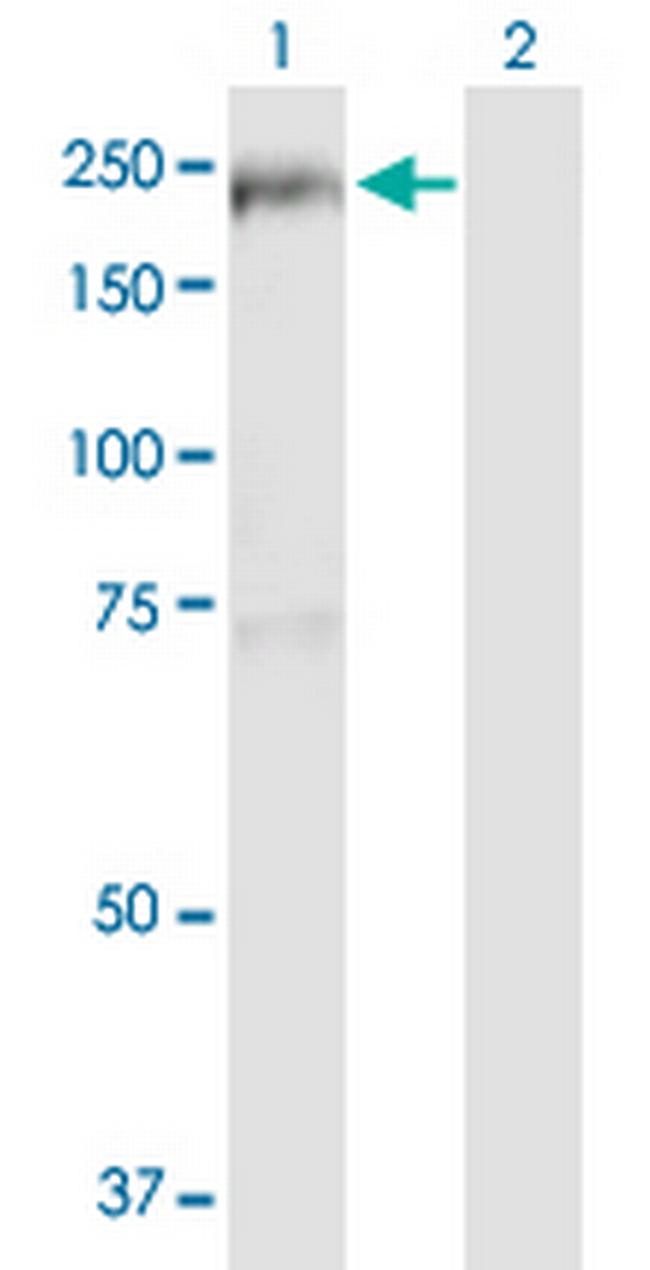 TBC1D1 Antibody in Western Blot (WB)