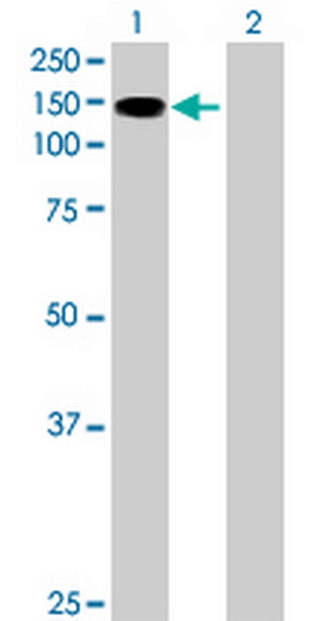 SIK2 Antibody in Western Blot (WB)