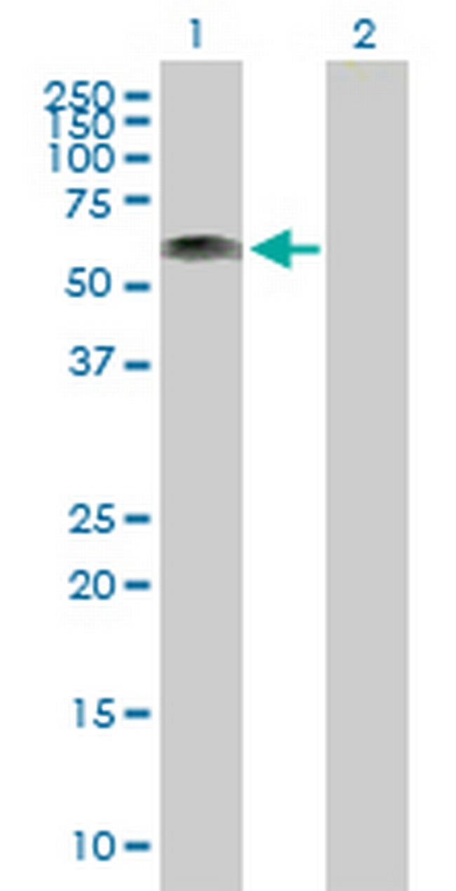 RP1-21O18.1 Antibody in Western Blot (WB)