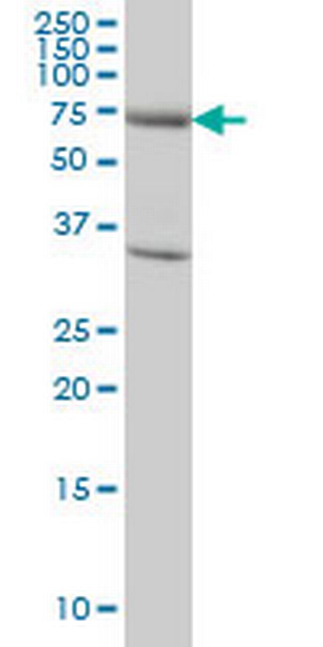 EXOC7 Antibody in Western Blot (WB)