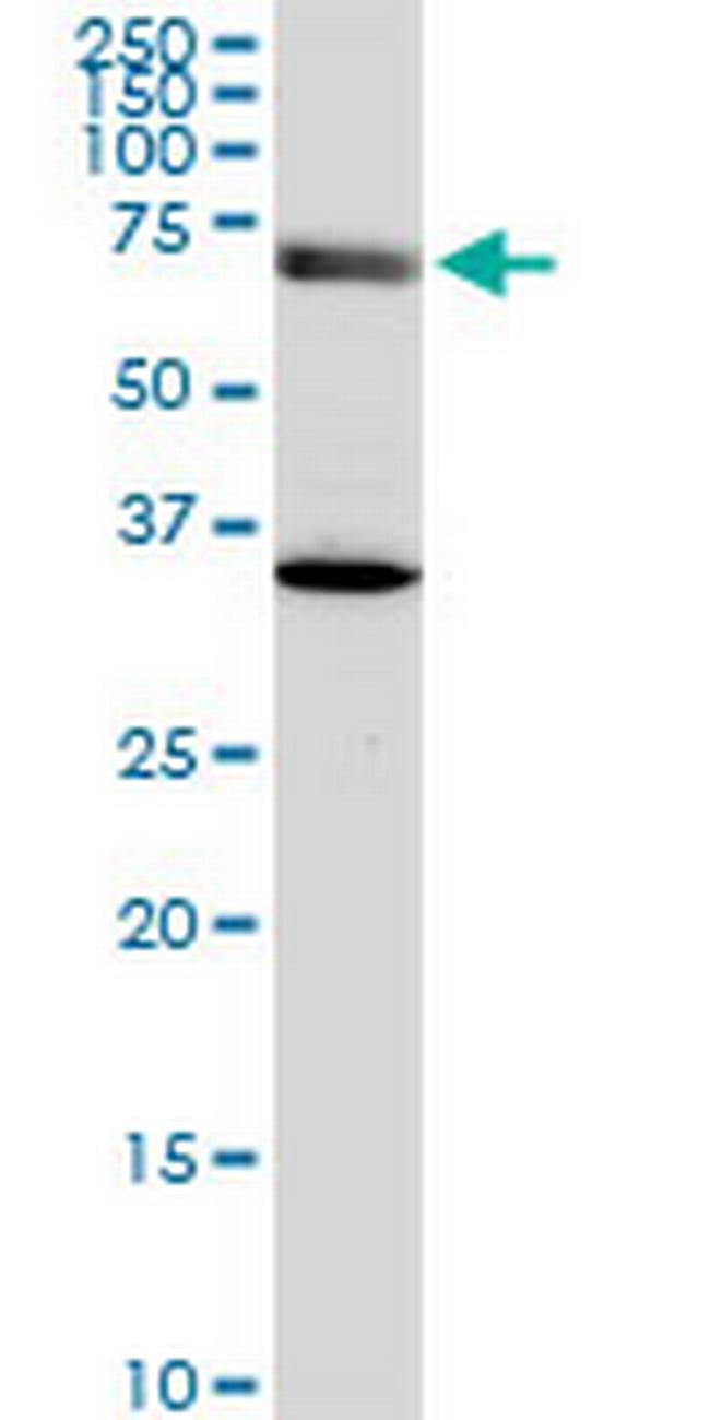 EXOC7 Antibody in Western Blot (WB)