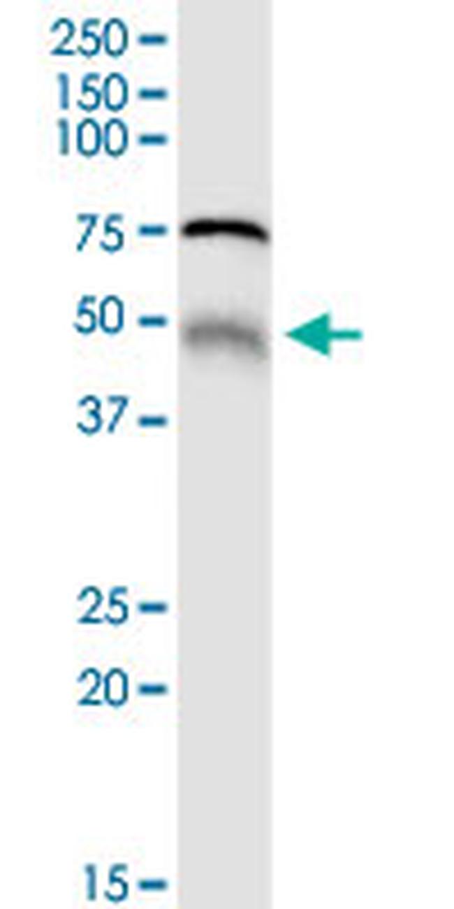 MGRN1 Antibody in Western Blot (WB)