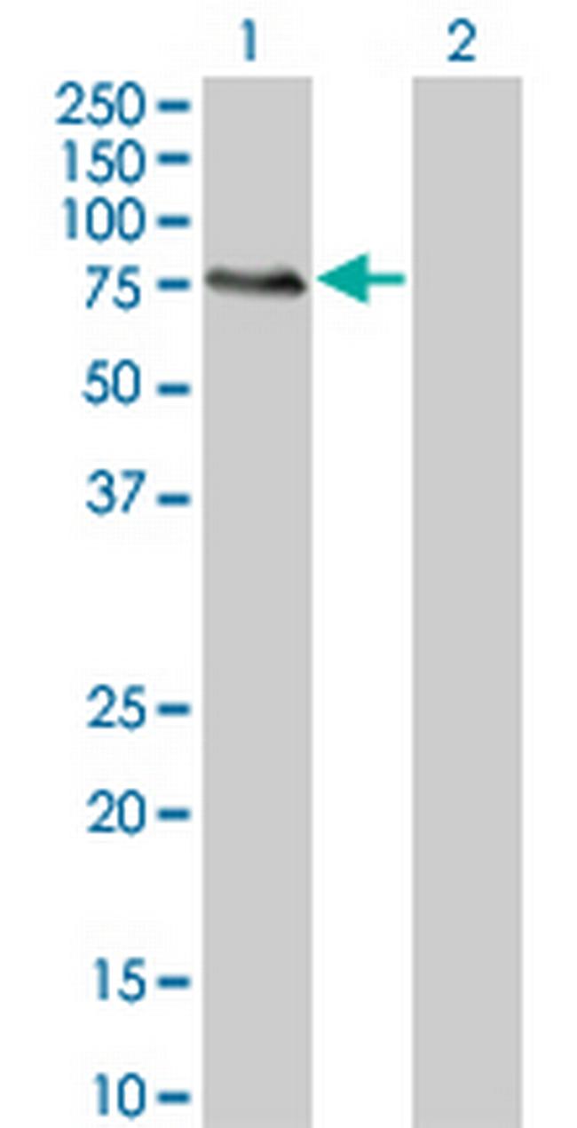 MGRN1 Antibody in Western Blot (WB)