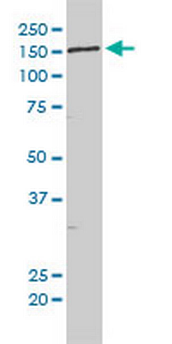 KIAA0056 Antibody in Western Blot (WB)