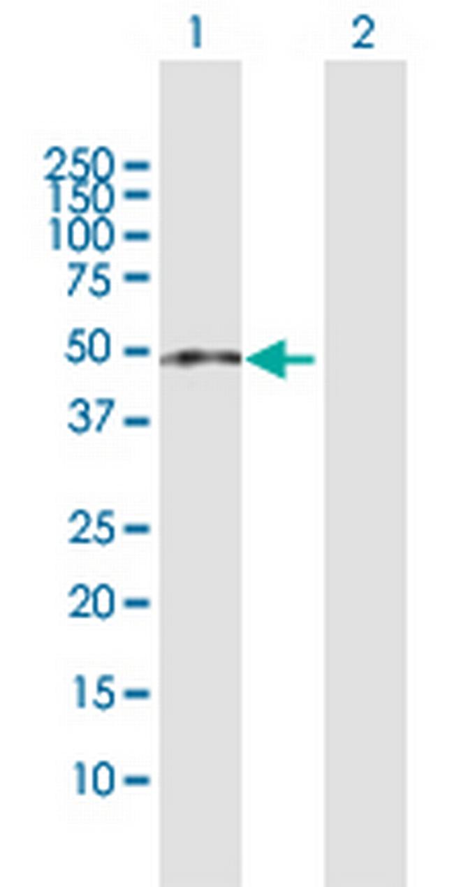 ZCCHC11 Antibody in Western Blot (WB)