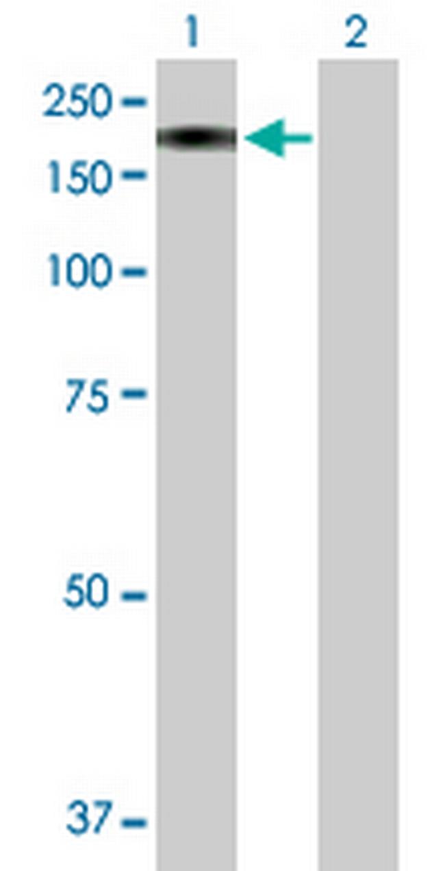 MAN2B2 Antibody in Western Blot (WB)