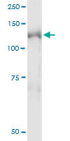 NEDD4L Antibody in Immunoprecipitation (IP)