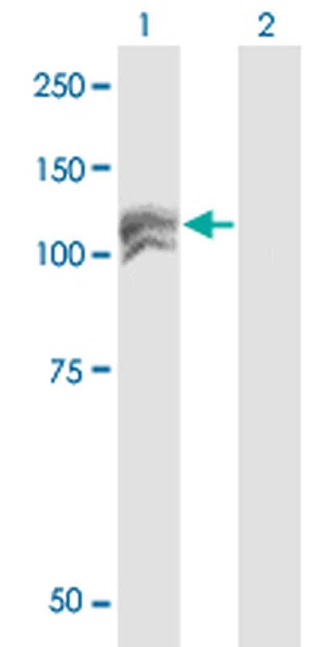 NEDD4L Antibody in Western Blot (WB)