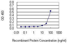 SASH1 Antibody in ELISA (ELISA)