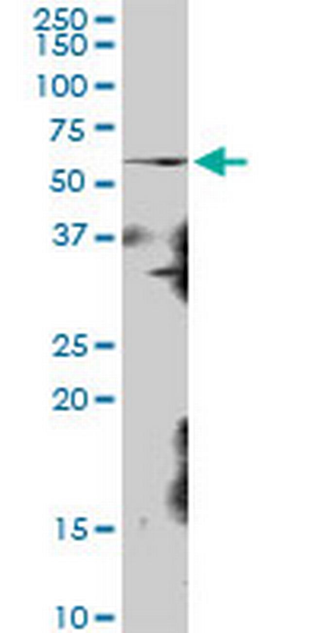 KIAA0409 Antibody in Western Blot (WB)