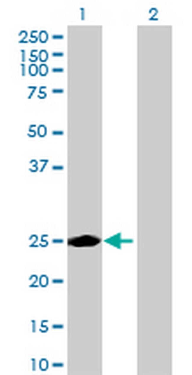 KIAA0892 Antibody in Western Blot (WB)