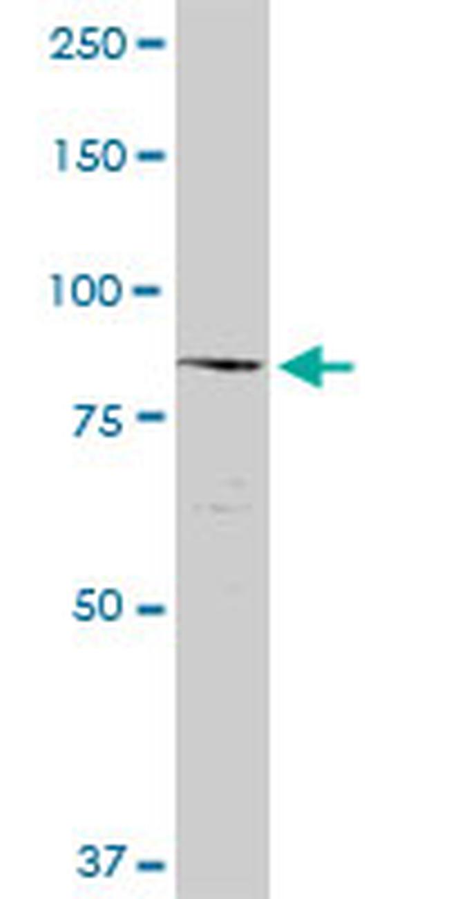 NCSTN Antibody in Western Blot (WB)