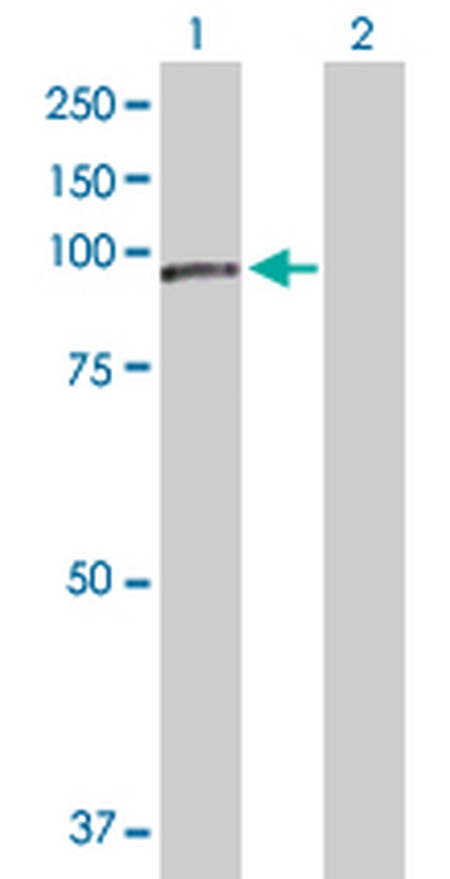 NCSTN Antibody in Western Blot (WB)